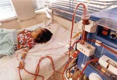 رشد شمار بیماران دیالیزی در شهرستان ابهر نگران کننده است