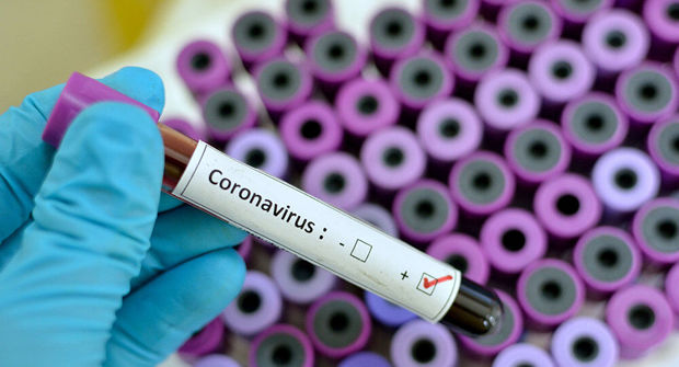 انجام ۲ هزار و ۹۳۹ آزمایش ویروس کرونا در خوزستان