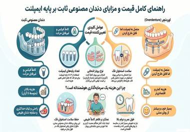 قیمت دندان مصنوعی ثابت بر پایه ایمپلنت چقدر است؟