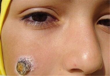 اعتبار مقابله با سالک در استان اصفهان پرداخت نشد