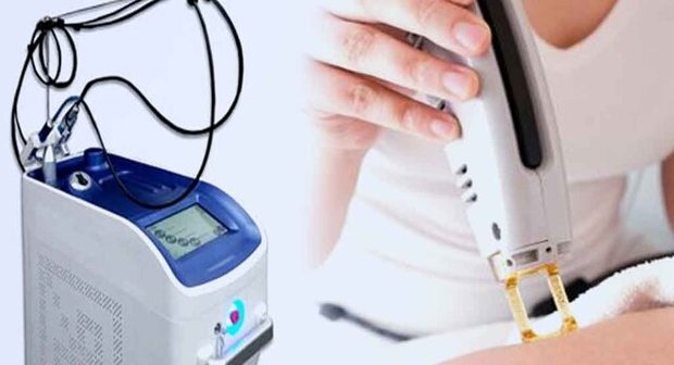 از لیزر انتظار معجزه نداشته باشید
