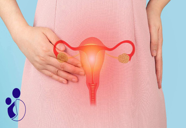 
چه زنانی در معرض خطر ابتلا به پولیپ رحم قرار دارند؟