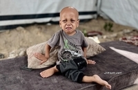  فریاد گرسنگی در چشمان یک کودک (4)