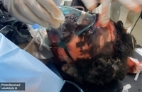 حمله آمریکا به یمن (8)