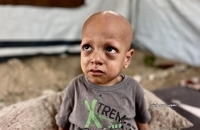  فریاد گرسنگی در چشمان یک کودک (10)