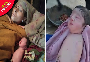 یک نوزاد بدون دست و پا در هند متولد شد+ عکس و فیلم