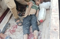 شهادت دردناک کودکان فلسطینی در حمله اسرائیل (3)