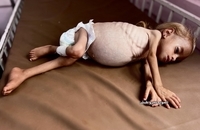 شام قدیح، کودک دو ساله فلسطینی (4)