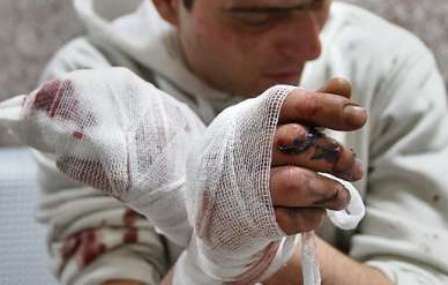 مواد محترقه 130 شهروند همدانی را راهی بیمارستان کرد