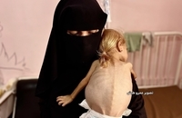 شام قدیح، کودک دو ساله فلسطینی (10)