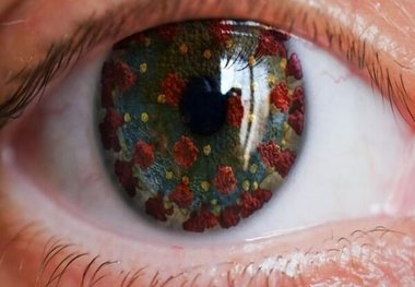 علائم کرونای چشمی را جدی بگیرید
