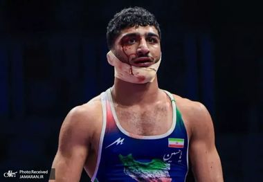 افشاگری پزشک ایرانی اتحادیه جهانی؛ ضربات کشتی گیر فرانسوی به سهرابی عمدی بود+ عکس