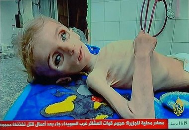 تصاویر وحشتناک از غزه که قلب را به درد می‌آورد/ جان باختن کودکی دیگر در غزه بر اثر سوء تغذیه