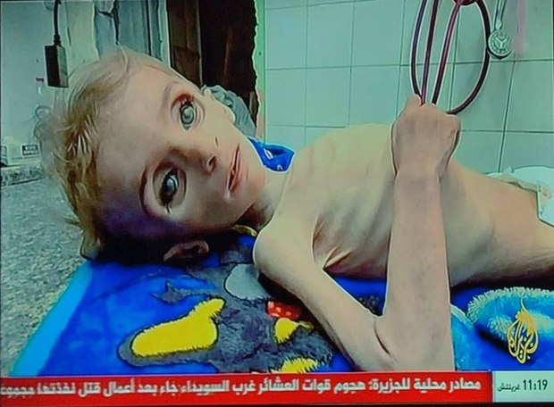 تصاویر وحشتناک از غزه که قلب را به درد می‌آورد/ جان باختن کودکی دیگر در غزه بر اثر سوء تغذیه