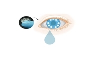 تشخیص سرطان با بررسی مواد شیمیایی موجود در اشک