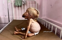 شام قدیح، کودک دو ساله فلسطینی (2)