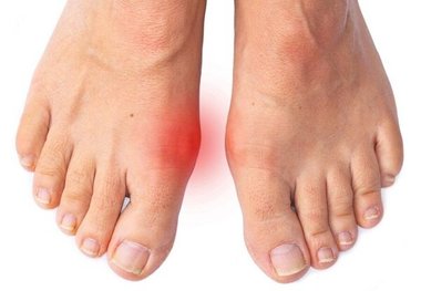 درد شست پا می‌تواند نشانه بیماری‌های جدی باشد
