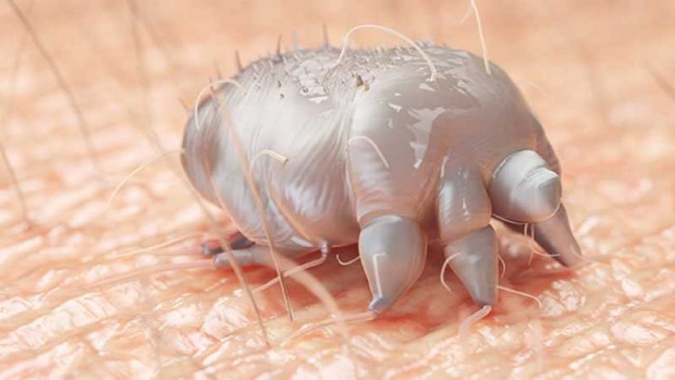  بیماری گال چیست؟+ چند راهکار خانگی
