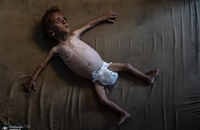 عکس‌های دلخراش از غزه (3)