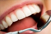 روش‌های جالب خانگی برای از بین بردن جرم دندان
