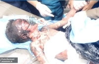 حمله آمریکا به یمن (7)