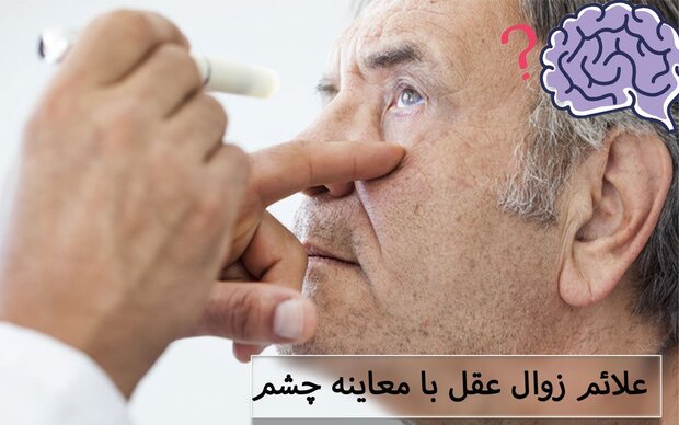 ارتباط بین سلامت چشم و بیماری آلزایمر در سالمندان