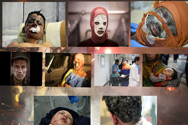 حوادث چهارشنبه سوری در قزوین ۳۰ مجروح برجای گذاشت