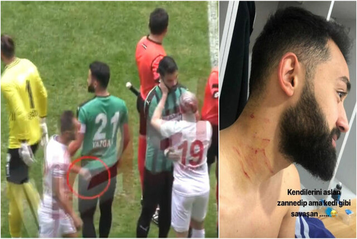 چاقوکشی در لیگ فوتبال ترکیه+ عکس
