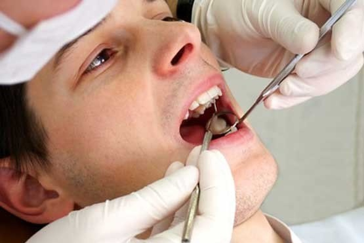 برنامه‌های وزارت بهداشت برای ساماندهی ارایه خدمات دهان و دندان