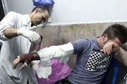 34 نفر درحوادث شب چهارشنبه سوری در شهرستانهای غرب استان تهران مصدوم شدند