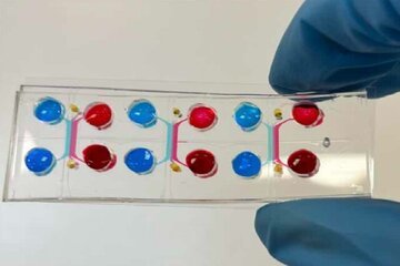 درمان سرطان با یک تراشه