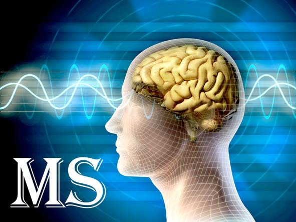 درمانگاه تخصصی MS در مرکز آموزشی، درمانی علوی اردبیل راه اندازی شد