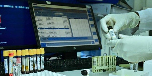  بیش از 30 نمونه تست دوپینگ ورزشکاران ایرانی به آزمایشگاه قطر ارسال شد
