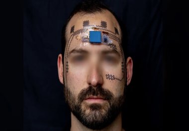 کنترل استرس با برچسب پیشانی