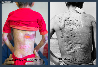 از هیباکوشا تا قربانیان تحریم: رنج، تاب‌آوری و امید