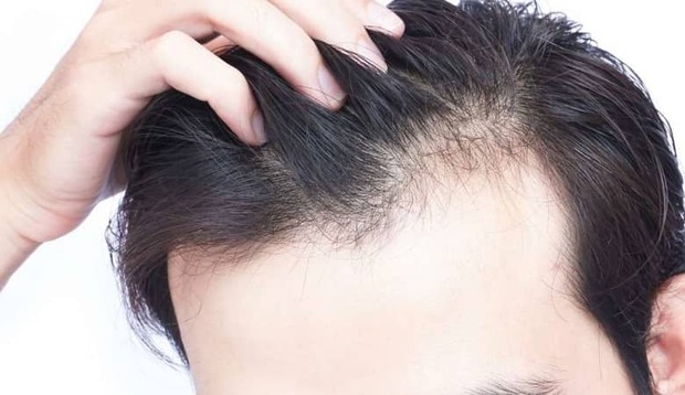 درمانی جدید برای ریزش مو
