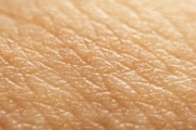 مردان بیشتر در معرض ابتلا به بیماری پوستی