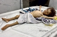 شهادت کودک فلسطینی بر اثر گرسنگی در جنوب غزه (6)