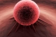 کشف جدید دانشمندان درباره علت سرطان