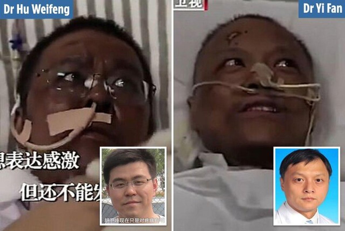 سیاه شدن پوست دو پزشک مبتلا به کرونا در ووهان/ عکس