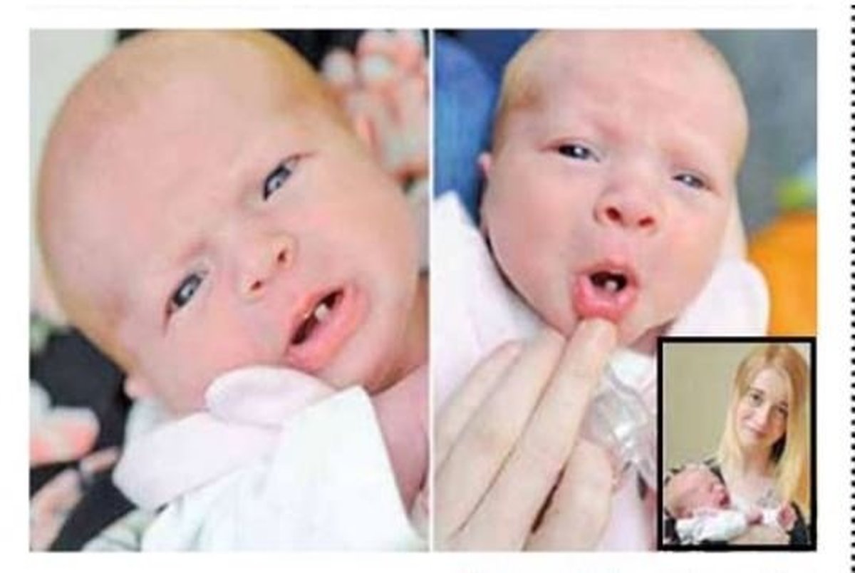 دختری که با یک دندان به دنیا آمد+عکس