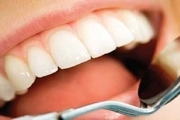 در ۳ دقیقه دندان‌های خود را سفید کنید!
