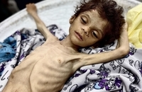 شهادت کودک فلسطینی بر اثر گرسنگی در جنوب غزه (8)