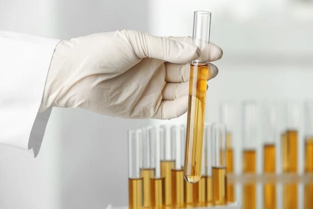 ابداع حسگری برای پوشک به منظور تجزیه و تحلیل ادرار
