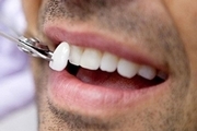 چرا لمینت دندان قیمت بالایی دارد؟