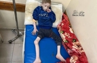 وضعیت وحشتناک کودک فلسطینی به خاطر قحطی در غزه (2)