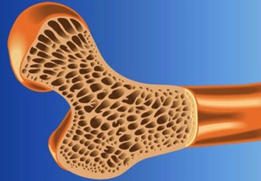 تاثیر مصرف پروتئین بیشتر در استخوان ها