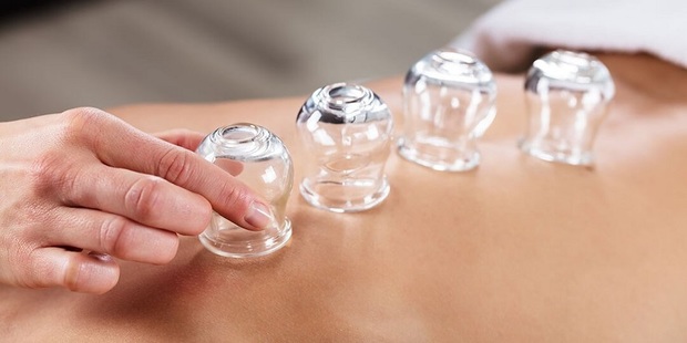 
هر آنچه باید درباره بادکش‌درمانی بدانید