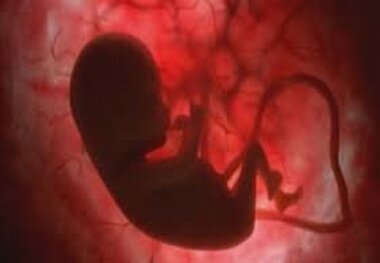 افزایش احتمال ابتلای کودک به اوتیسم با مصرف ماریجوانا در دوران بارداری مادر