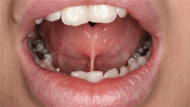 زبان کرواتی به چه شکل است؟
